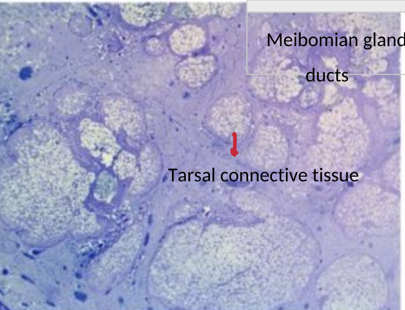 <p><span style="background-color: inherit; line-height: 20.7px; color: windowtext;"><span>Sebaceous glands consisting of multiple secretory acini which open onto a central duct</span></span><span style="line-height: 20.7px; color: windowtext;"><span>&nbsp;</span></span></p><p class="Paragraph SCXO233074334 BCX0" style="text-align: left;"><span style="background-color: inherit; line-height: 20.7px; color: windowtext;"><span>Discharges contents onto lid margin</span></span><span style="line-height: 20.7px; color: windowtext;"><span>&nbsp;</span></span></p>