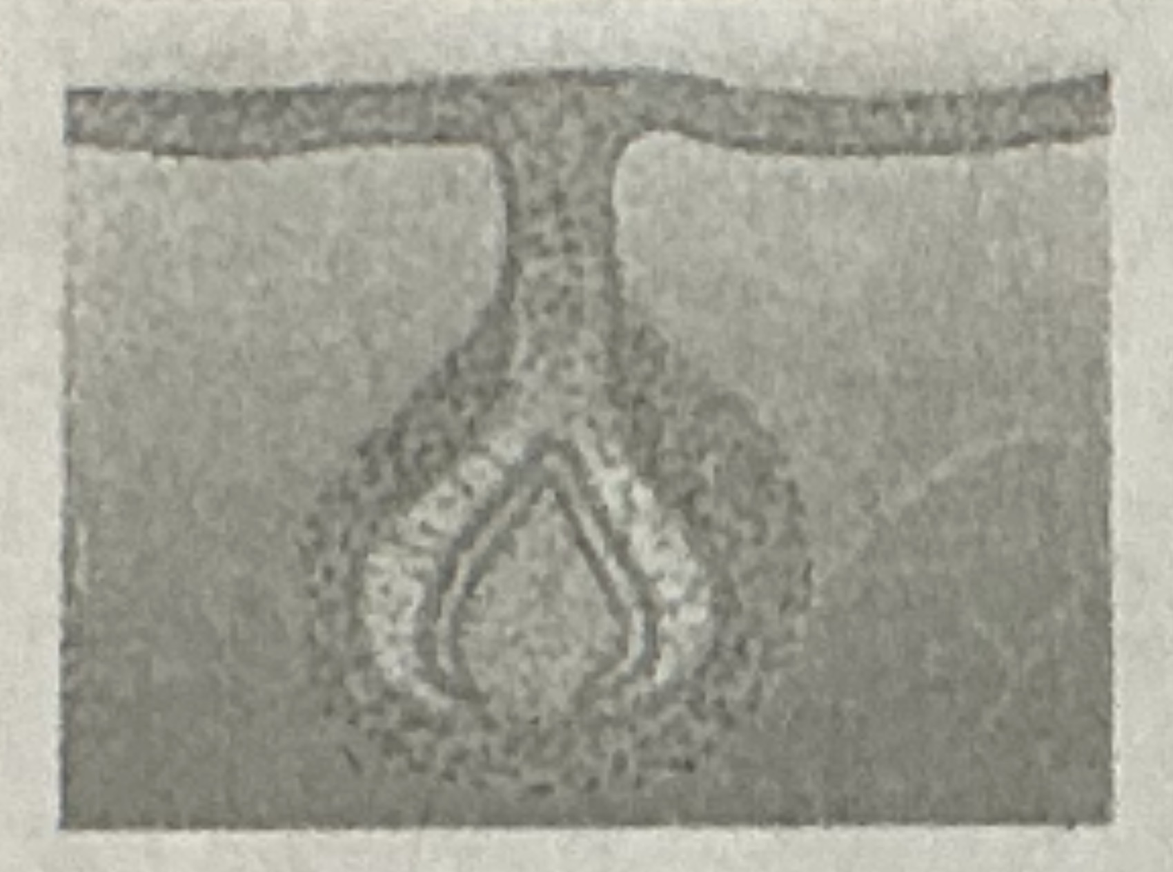 <p>What Stage Is This</p>