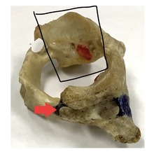 <p>what is marked? (not the arrow)</p>