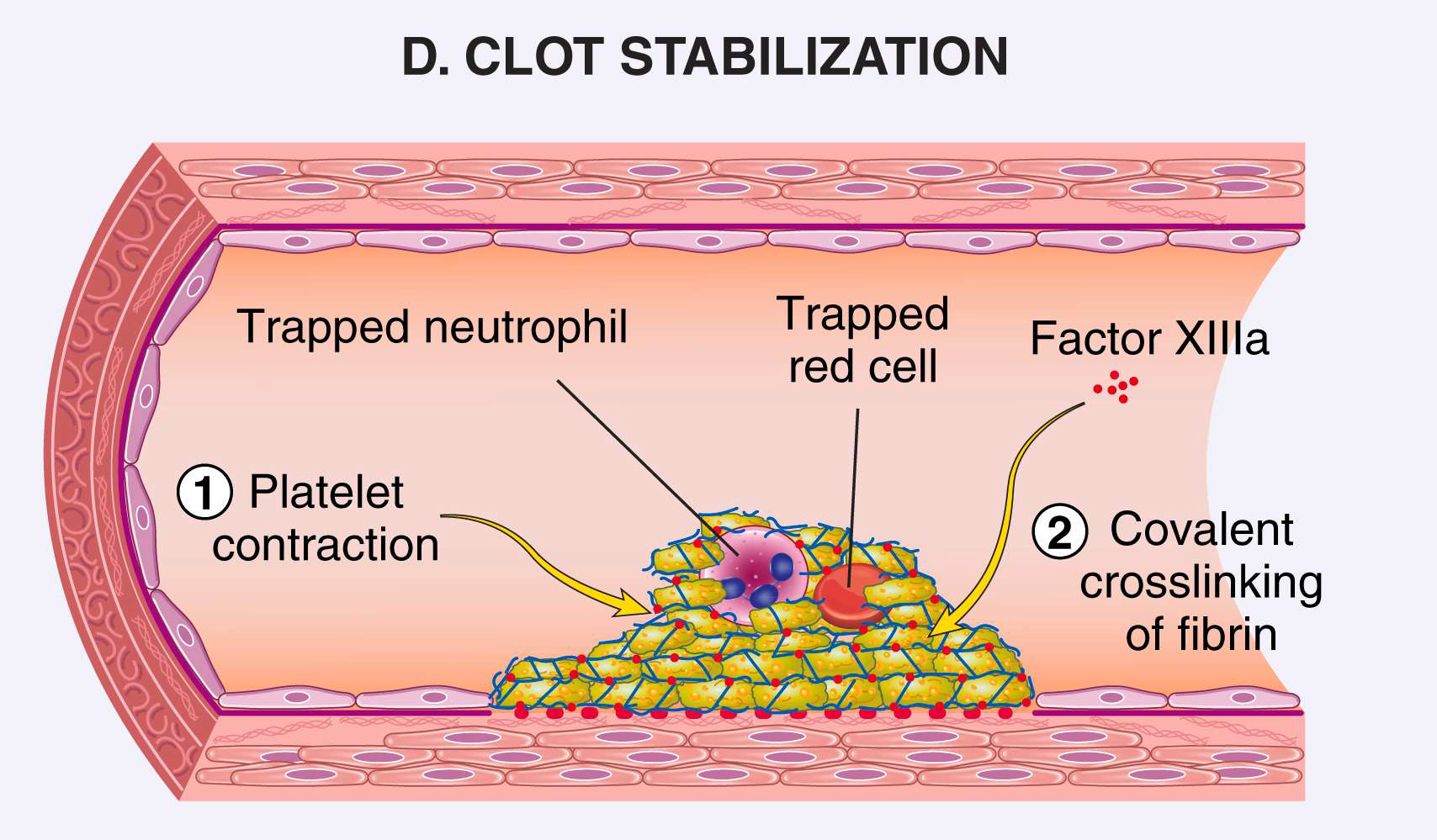 <p>Fibrin and platelet aggregates <strong>contract to form permanent platelet plug</strong></p>