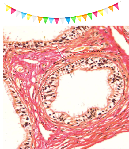 <ul><li><p>Epitel <strong><em>(Guirlandelignende lumen)</em></strong>: <strong>Enlaget cylindrisk</strong>, som består af <strong><em>ciliebærende celler</em></strong> (transport af spermatozoer) og <strong><em>absorptive celler</em></strong> (apikal mikrovilli)</p></li><li><p><strong>BM</strong></p></li><li><p>Tunica muscularis: <strong>Cirkulært glat muskulatu</strong>r</p></li></ul><p></p>