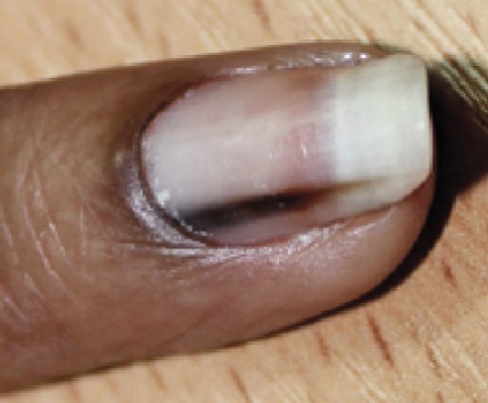 <p></p>