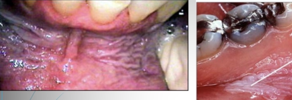 <p>What is this condition </p>