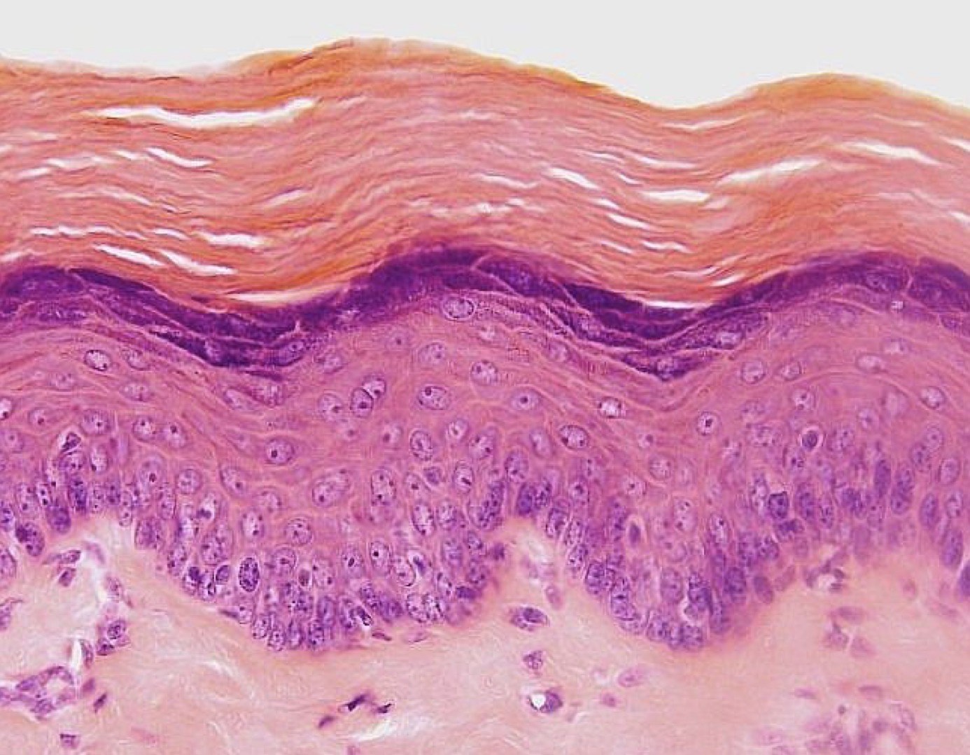 <p>What are Stratum spinosum Features?</p>