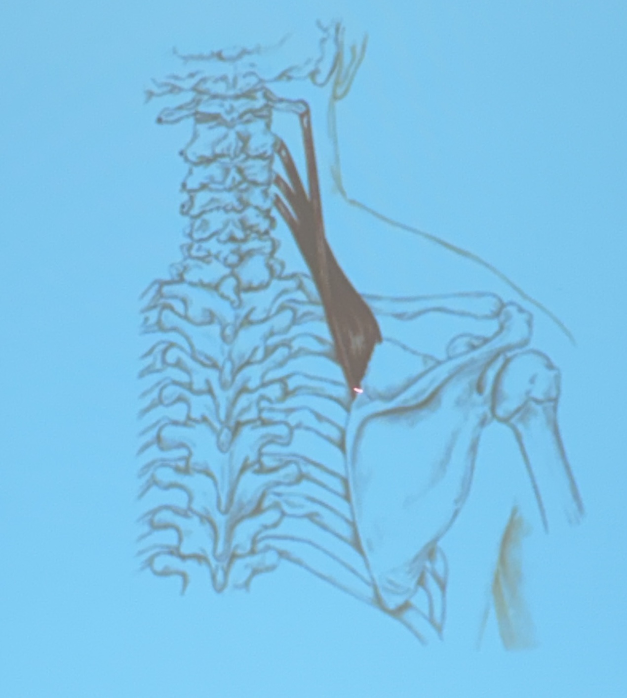 <p>Muscle name?</p>