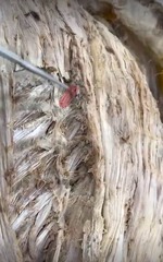 <p>Name the muscle</p>