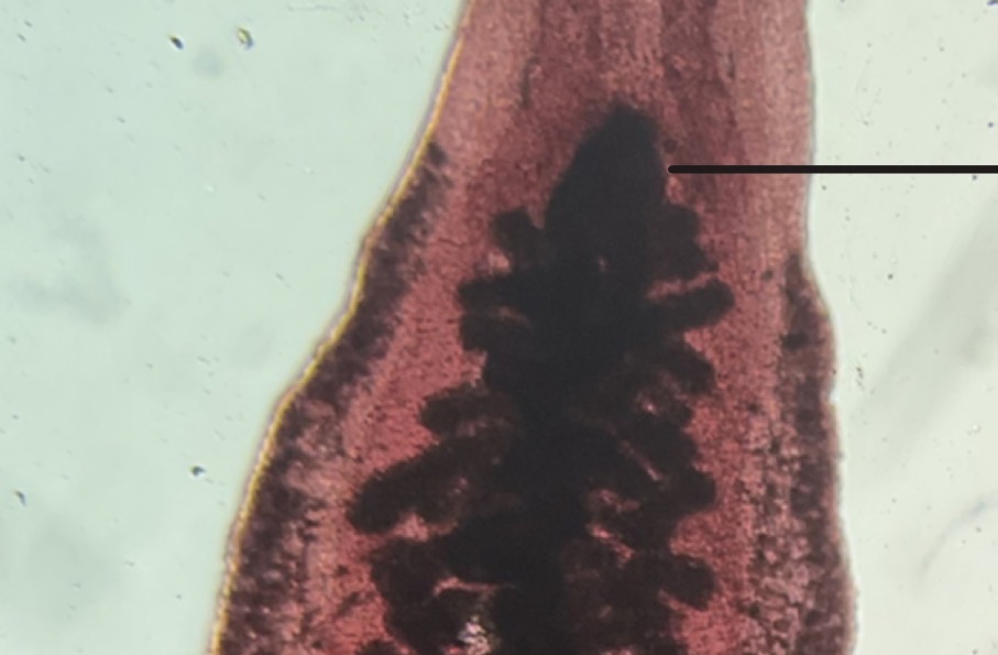 <p>Ventral sucker</p>