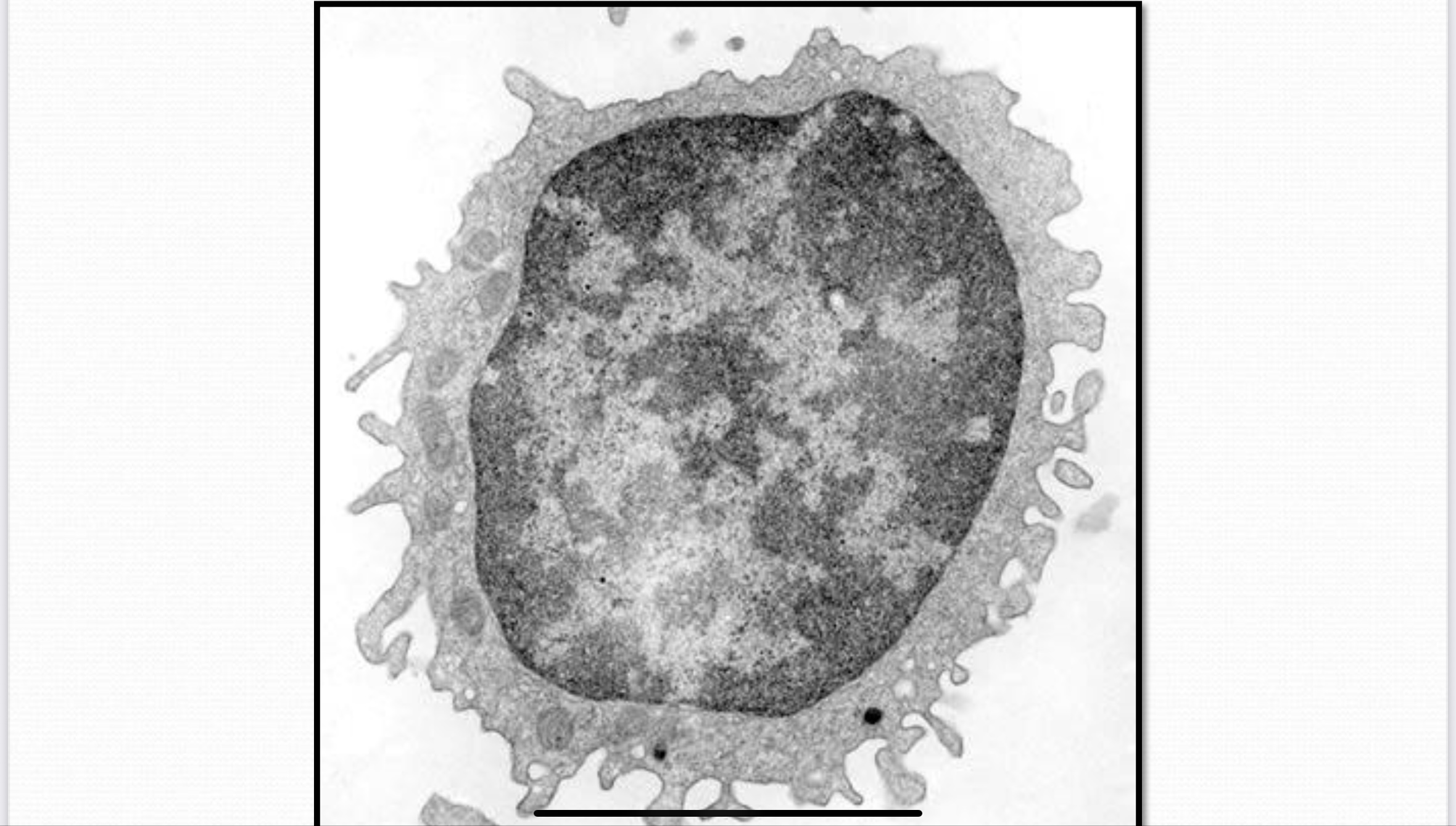 <p>White Adipose Connective Tissue</p>