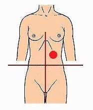 <p>identify the region of the abdomen:</p>