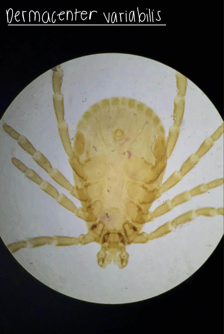 <p>Dermacentor variabilis</p>