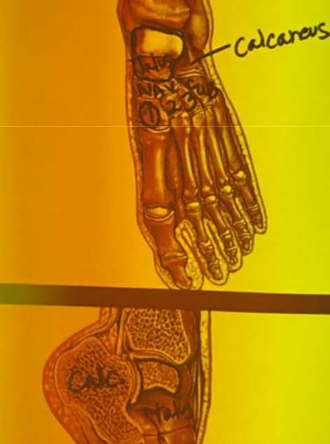 <ul><li><p><span style="background-color: transparent;">Intertarsal Joints (tarsal = </span><strong>ankle and rear part of the foot</strong>)</p><ul><li><p><span style="background-color: transparent;">Joint Type: <strong>Synovial – gliding</strong></span></p></li><li><p><span style="background-color: transparent;">7 Tarsal Bones:</span></p><ul><li><p><span style="background-color: transparent;">Talus (trochlea)</span></p></li><li><p><span style="background-color: transparent;">Calcaneus</span></p></li><li><p><span style="background-color: transparent;">Navicular</span></p></li><li><p><span style="background-color: transparent;">Cuboid</span></p></li><li><p><span style="background-color: transparent;">Medial (#1) Cuneiform</span></p></li><li><p><span style="background-color: transparent;">Intermediate (#2) Cuneiform</span></p></li><li><p><span style="background-color: transparent;">Lateral (#3) Cuneiform</span></p></li></ul></li></ul></li></ul><p></p>