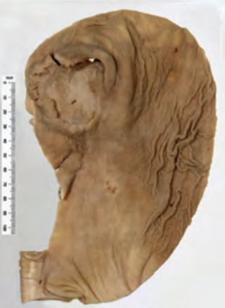 <p>Identify the POT</p>