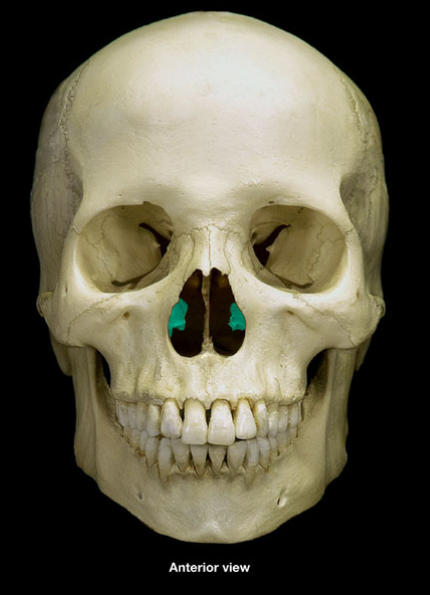 <p>What is the name of this bone?</p>