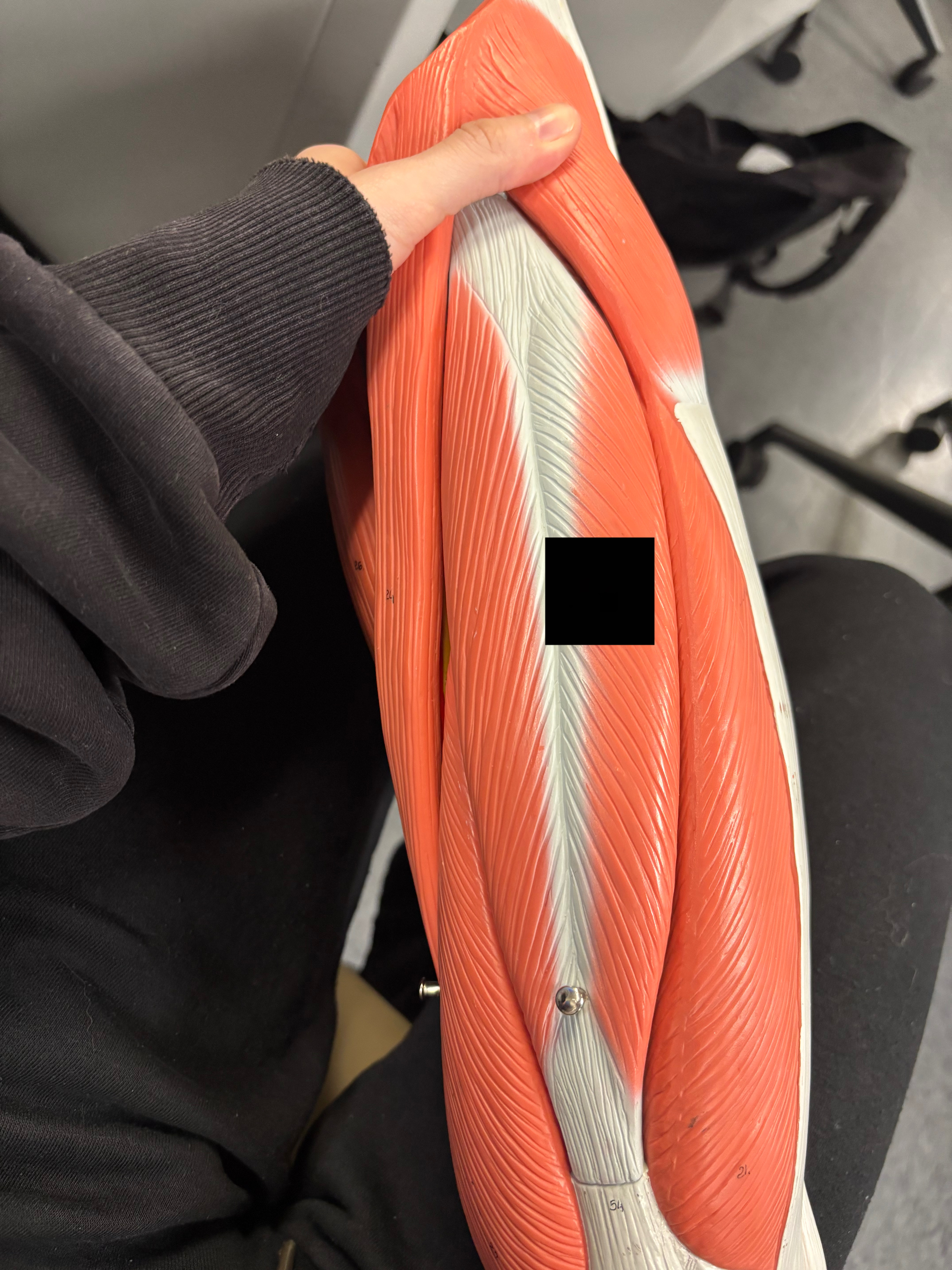 <p>What muscle is this and what is its action?</p>