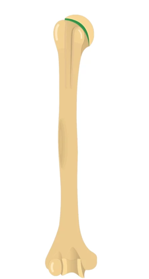 <p>What is this pointing to? What bone is it on?</p>