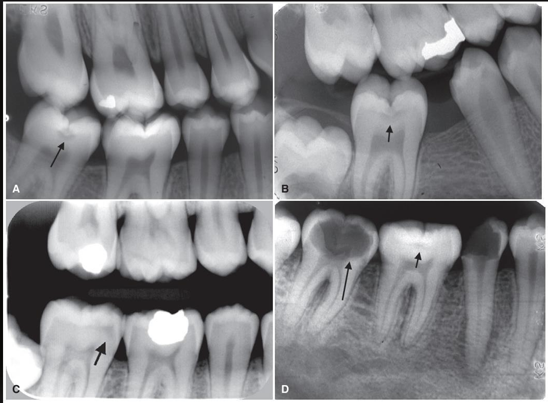 <p>what are these arrows pointing at?</p>