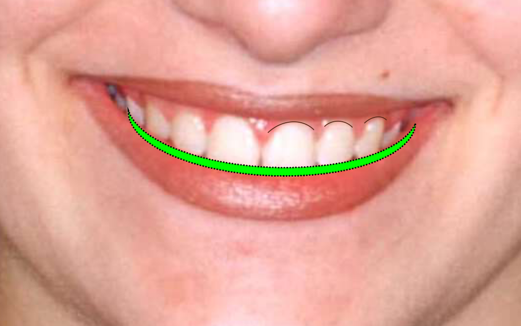 <p>lower</p>