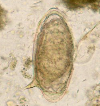 <p><span style="background-color: rgba(0, 0, 0, 0); line-height: 19.7625px;">What is the species in this photo? What type of egg? How do you get infected with it?</span></p>