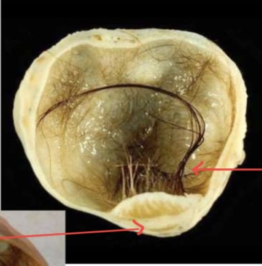 term image