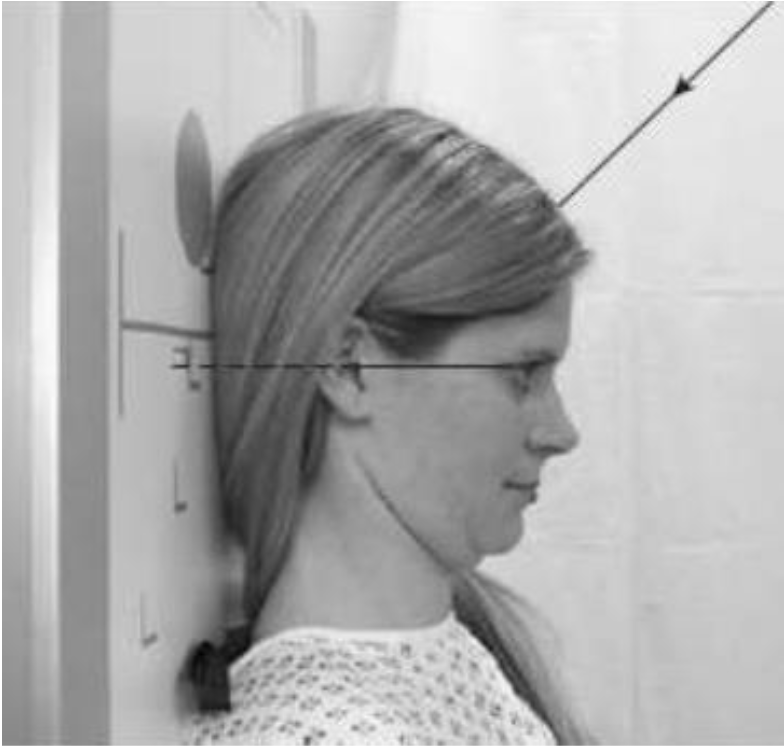 <p>Broad FS, 100cm</p><p>80kVp, 30mAs</p><p>Orbitomeatal line parallel to floor/perpendicular to IR</p><p>Tube angle 30 degrees caudal</p><p>CR: midline 5cm above glabella</p>
