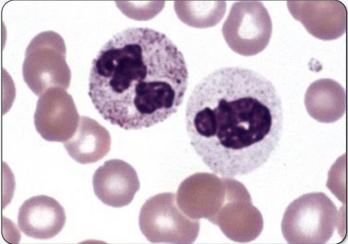 <p>What neutrophilic change is present here? </p>