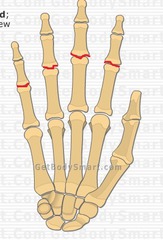 <p>between proximal and middle phalanges</p>