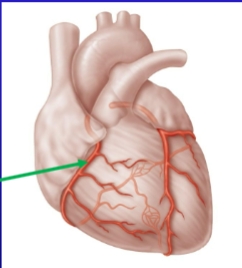 <p>Name of the artery</p>