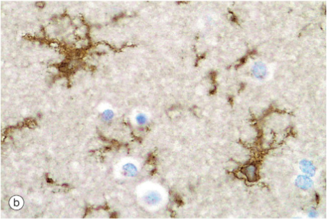 <p>smallest neuroglia; macrophages resident to CNS (Phagocytic); only Nuclei are visible unless special stain is used</p>
