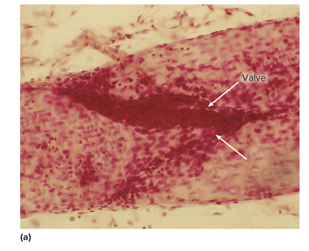 <p>this is an image of </p>