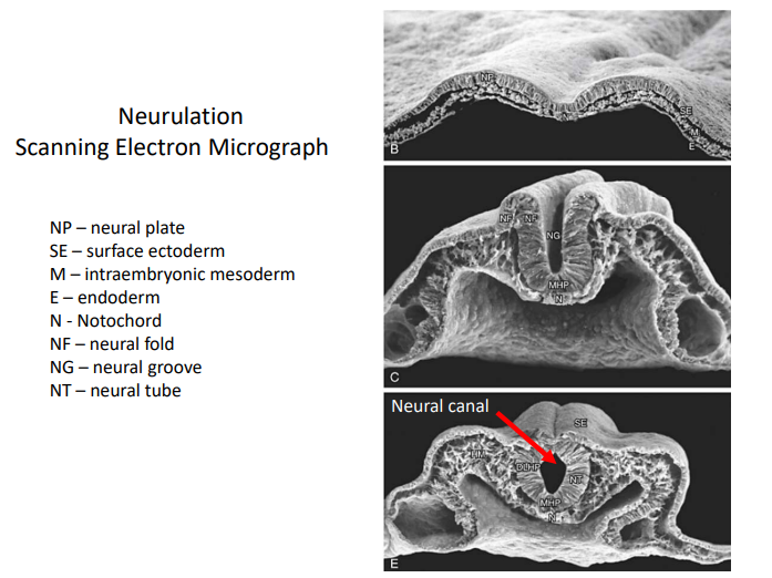 <p>Describe the process of primary neurulation.</p>