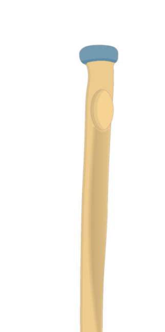 <p>What is this pointing to? What bone is it on?</p>