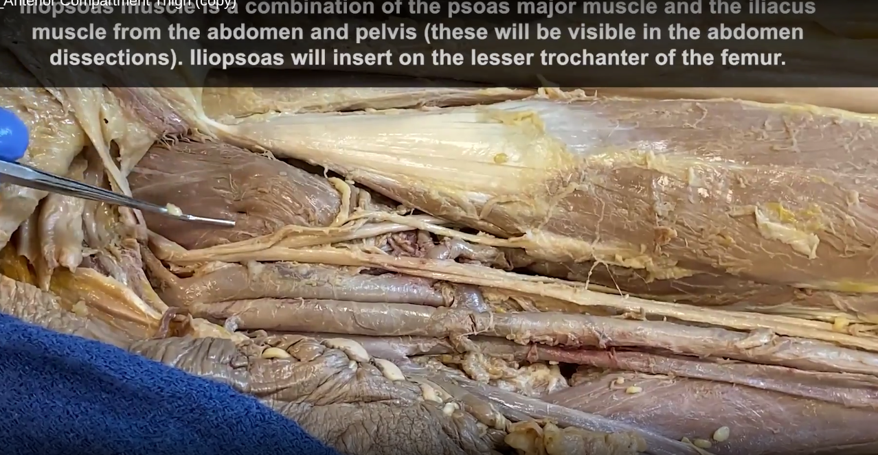 <ul><li><p>under sartorius</p></li><li><p>medial to rectus femoris</p></li></ul><p></p>
