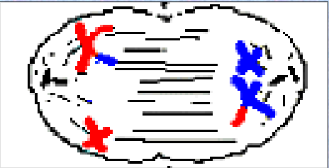 <p>_____ I</p><p>________ pairs <strong>separate </strong>with sister chromatids <strong>remaining together. </strong>Another source of genetic variation.</p>