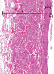 <p>What type of vein is shown?</p>