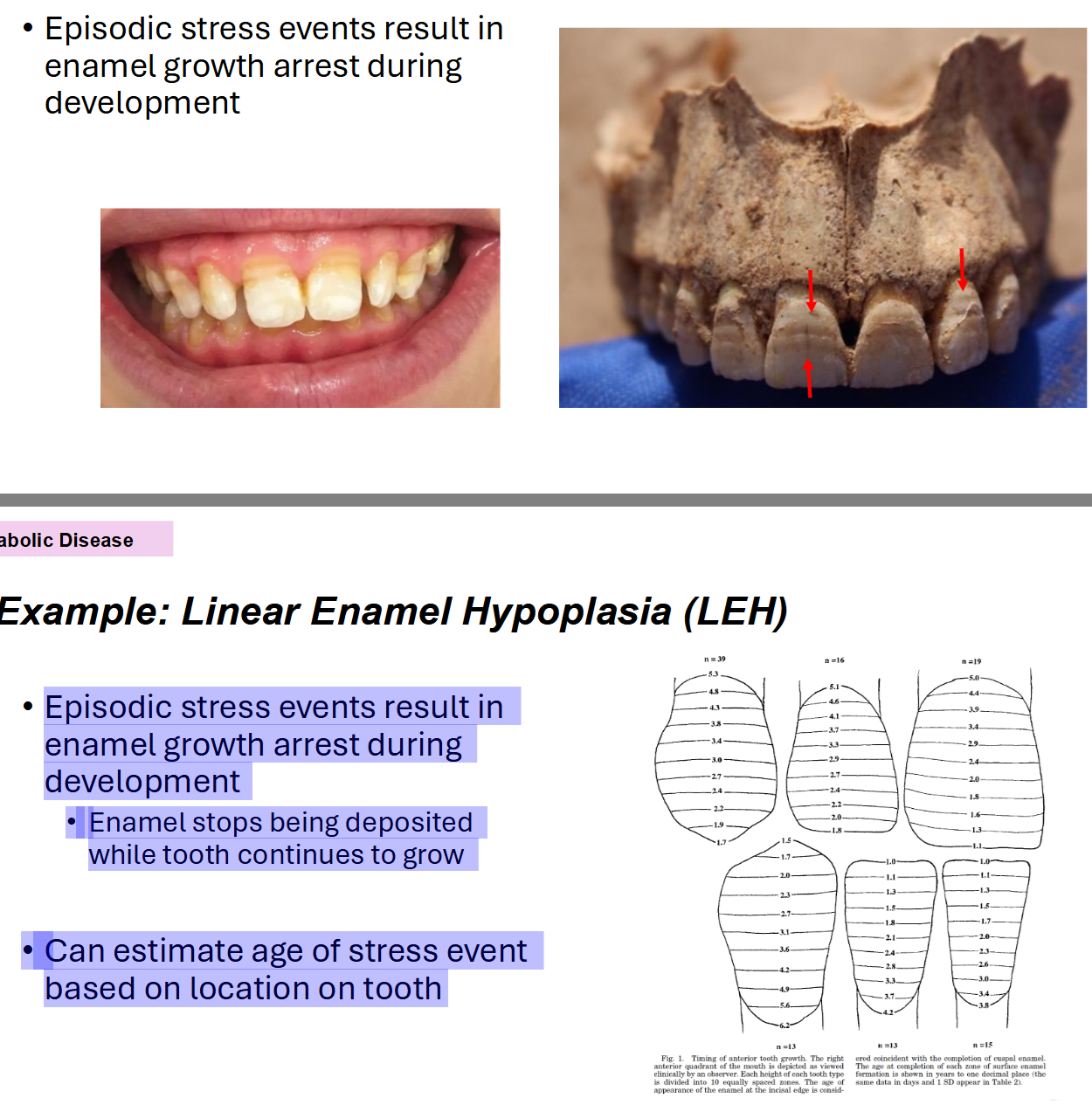 <p>Pathology: Metabolic Diseases Example: Linear Enamel Hypoplasia (LEH)</p>