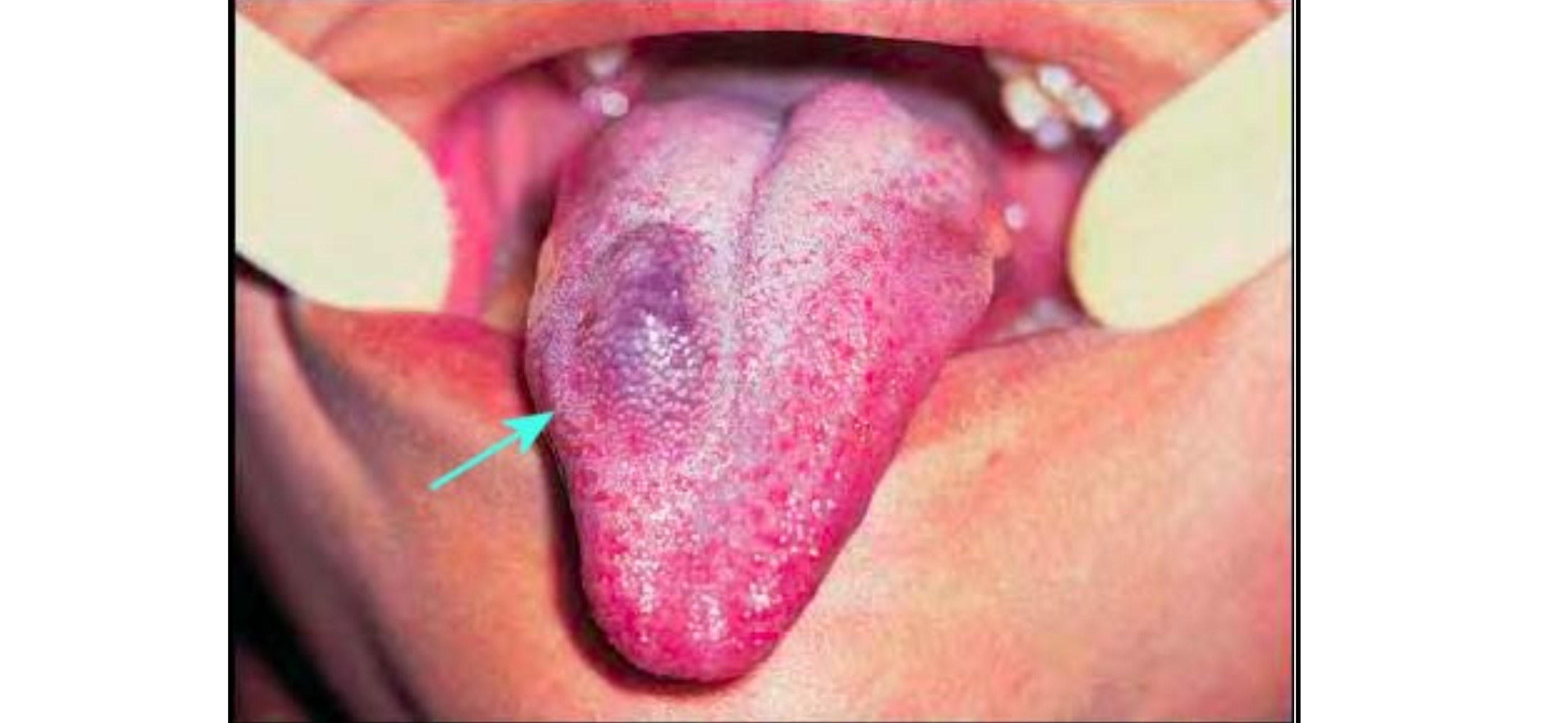 <p>Bệnh lý gì</p>