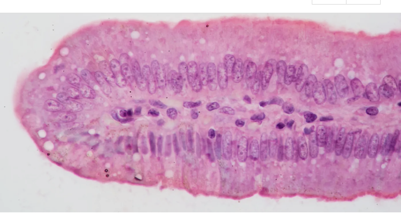 <p>What type of tissue</p>