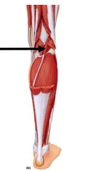 <p>posterior, shiny tendon between gastrocnemius and soleus</p>