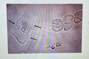 <p>Identity Urine Cell?BLACK Arrow</p>