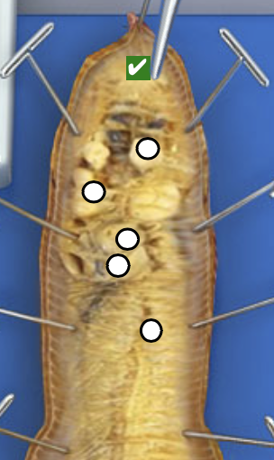 <p>What structure is this pointing to?</p>