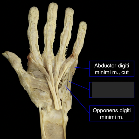 <p>what is this tagged area? What is the muscles, origin, insertion, innervation, and main actions? </p>