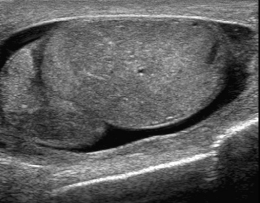 <p>What is the pathology</p>