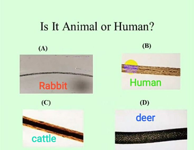 <p><strong><mark data-color="rgba(0, 0, 0, 0)" style="background-color: rgba(0, 0, 0, 0); color: inherit;">Examine the cuticle (scales), cortex (pigment), and medulla (central canal) to differentiate between human and animal origin</mark></strong><span>. Key indicators include the medullary index ( for human, for animal), scale patterns, root condition (forcibly removed vs. shed), and color, aiding in forensic identification.</span></p>