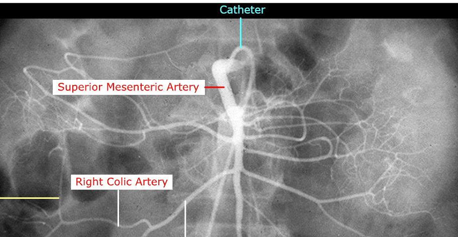 <p>Identify the structure that the white arrow is pointing at</p>