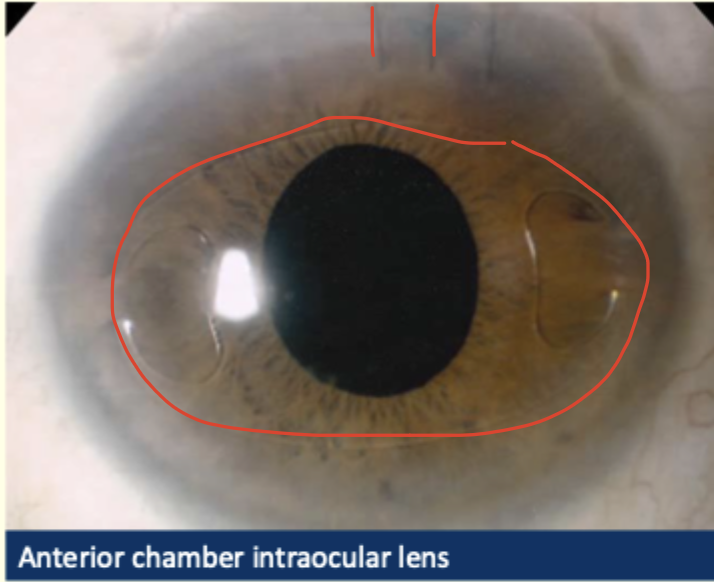 <p>describe and diagnose </p>