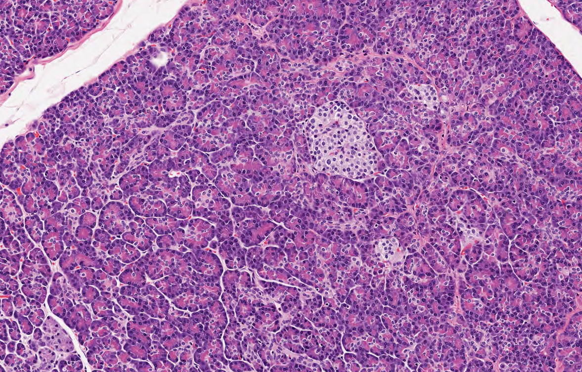 <p>Páncreas cuenta con unidades funcionales <strong>encargadas de secretar enzimas digestivas</strong>, identifica el componente exocrino (poner foto histológica)</p>