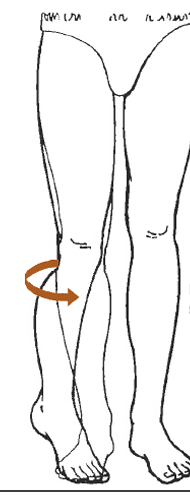 <p>What is this motion?</p>