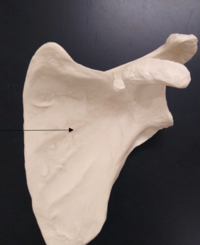 <p>What is this fossa (anterior side of the scapula)?</p>