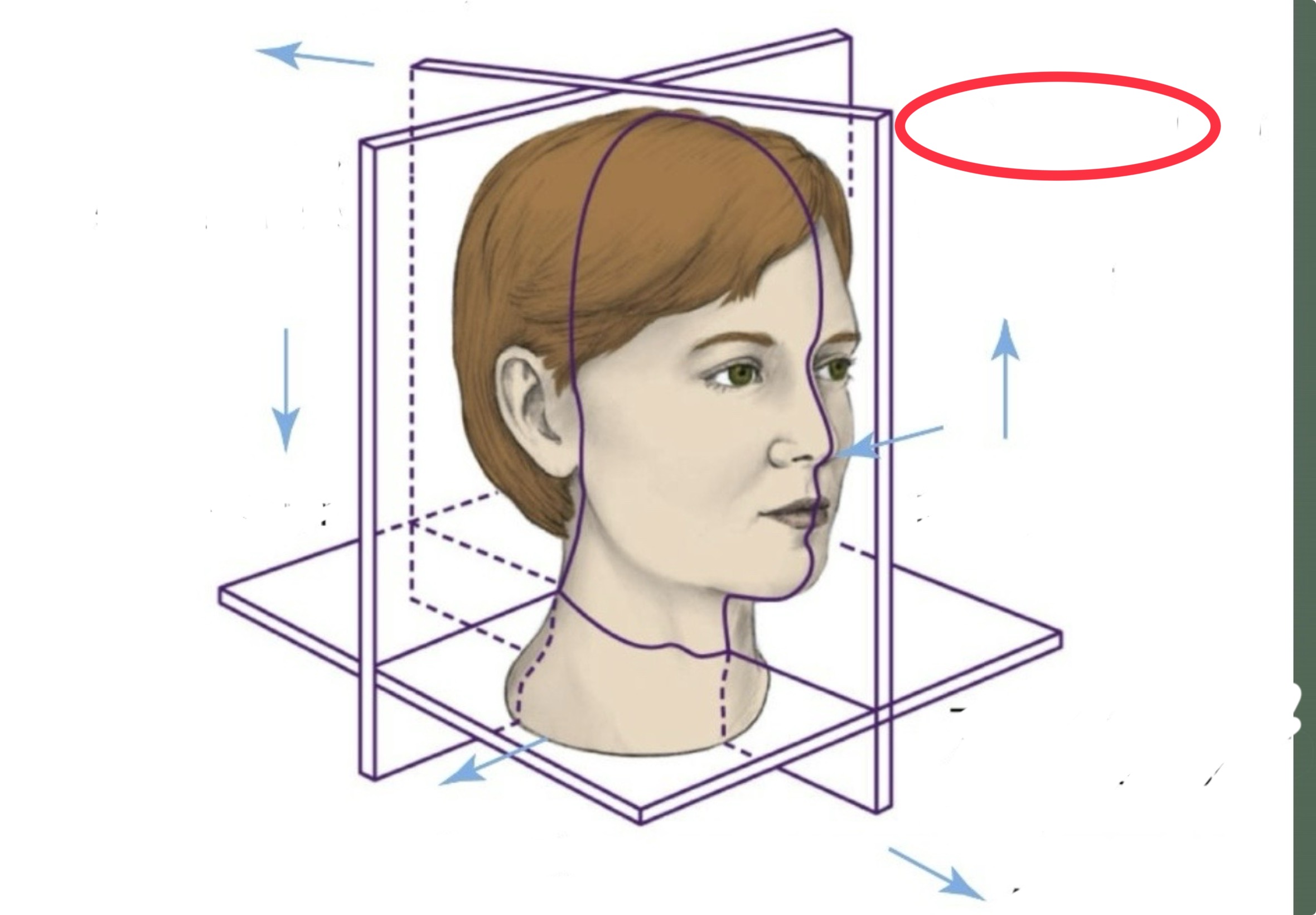 term image