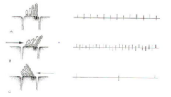 <p>Hair cells convert ________________________ into neural firing.</p>